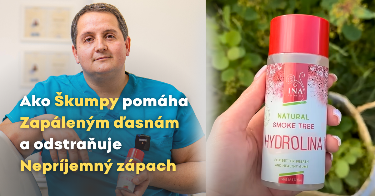 Ako sa zbaviť krvácajúcich ďasien a zlého dychu pomocou Ústna voda zo Škumpy vlasatej - Hydrolina?