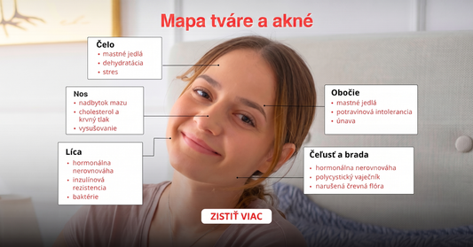 Mapa tváre pri akné podľa zón