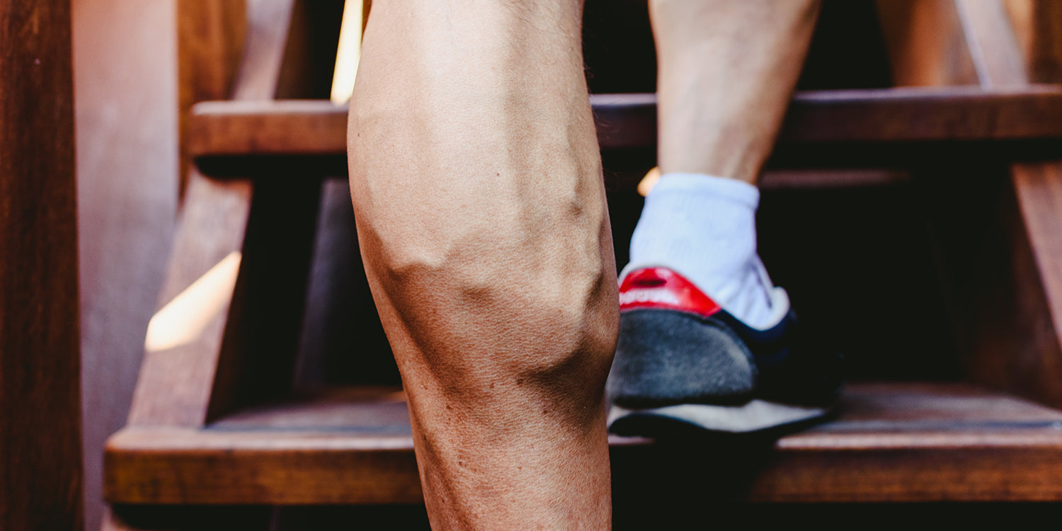 Viditeľné kŕčové žily na nohách počas fitnessu