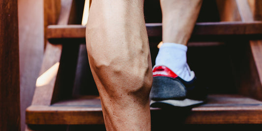 Viditeľné kŕčové žily na nohách počas fitnessu