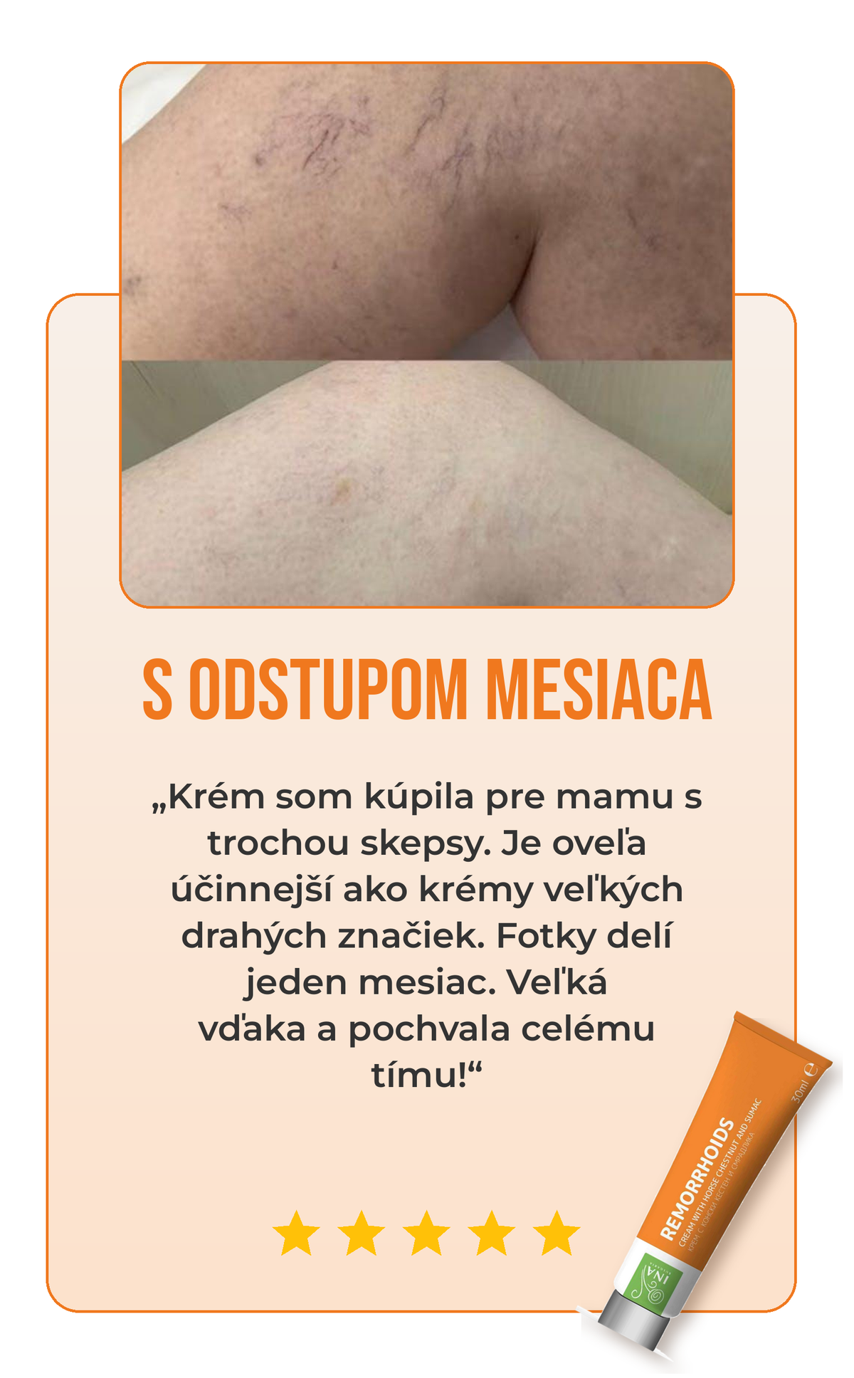 Recenzia krému na žily 1