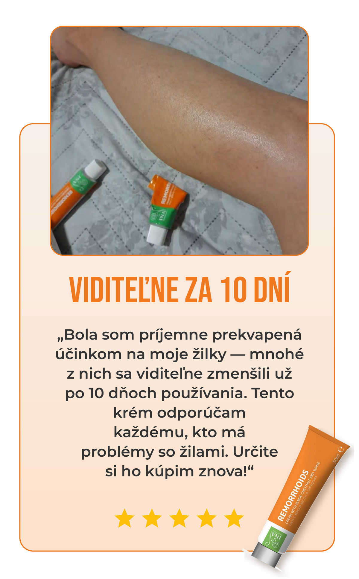 Recenzia krému na žily 2