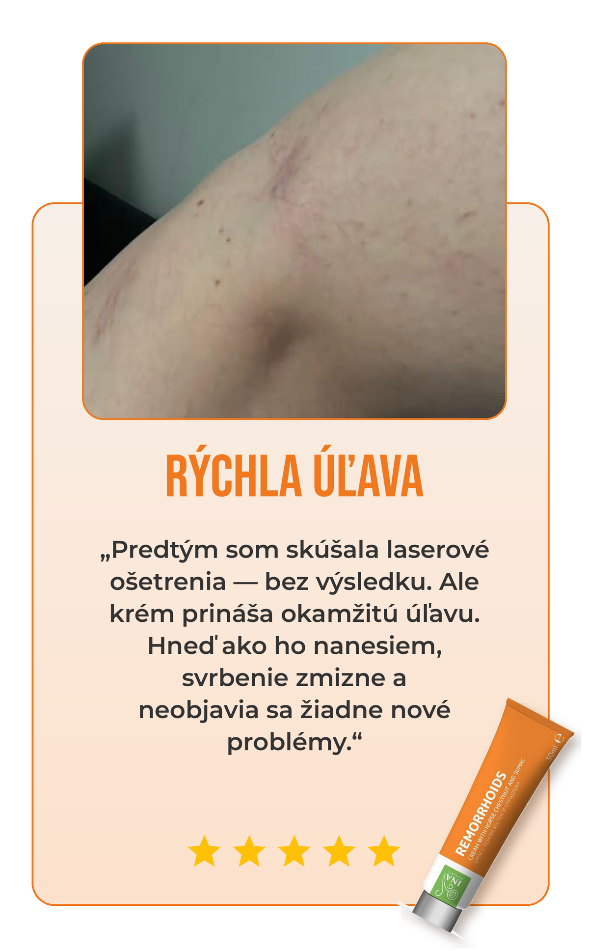 Recenzia krému na žily 3