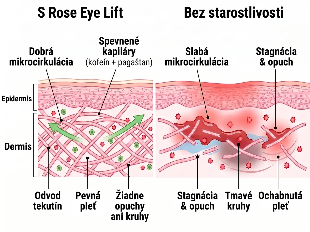 Rose Eye Lift SK t17