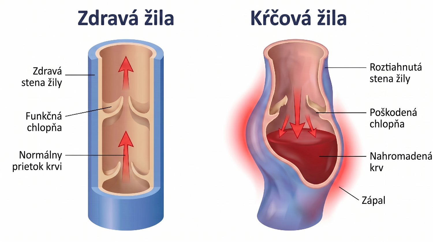periodontis_sk
