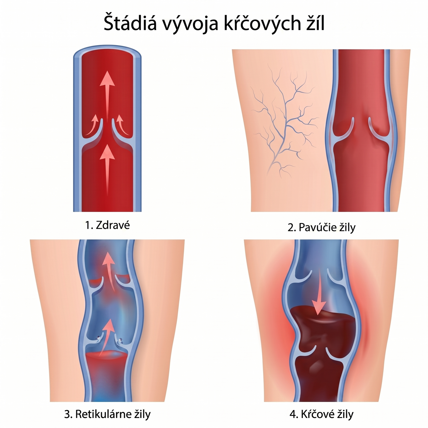 shutterstock_4stages_sk