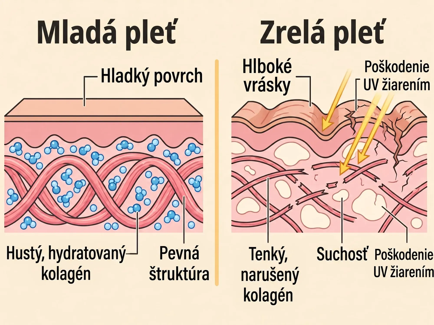 spf SK infographic