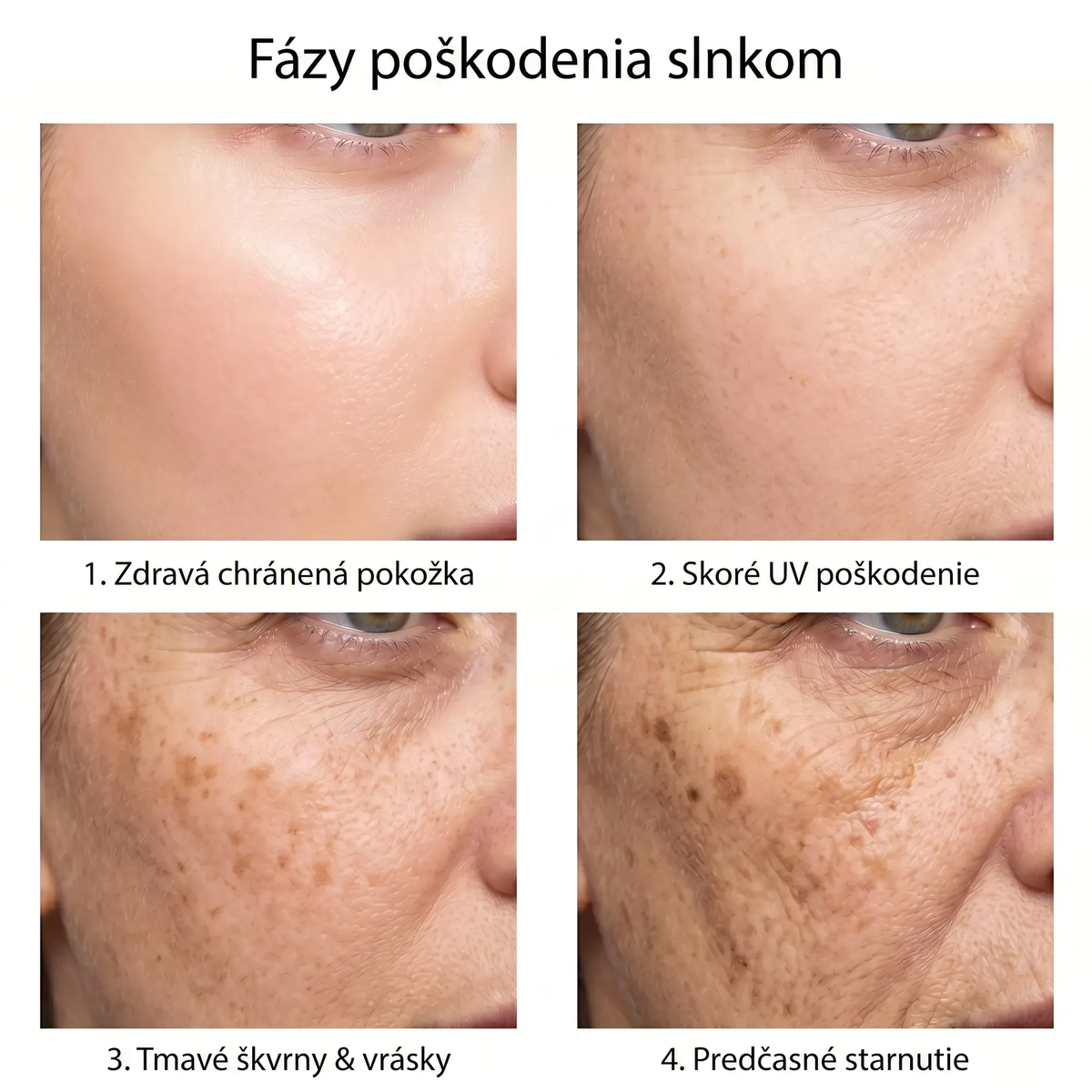 spf SK infographic